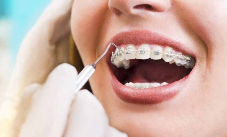 south kolkata best dental clinic