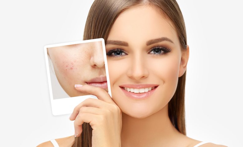 Dermatologist in Lahore