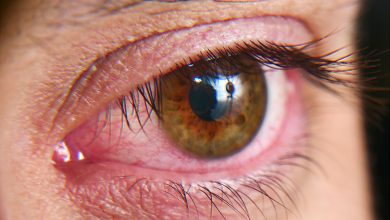 Dry eyes featured image
